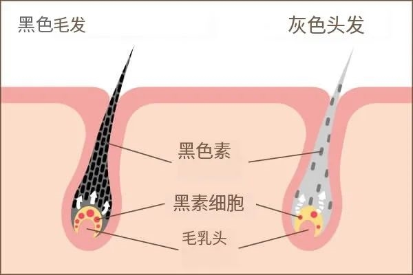 除了染發(fā) 頭發(fā)白了還能變黑嗎：醫(yī)生給的答案出乎意料