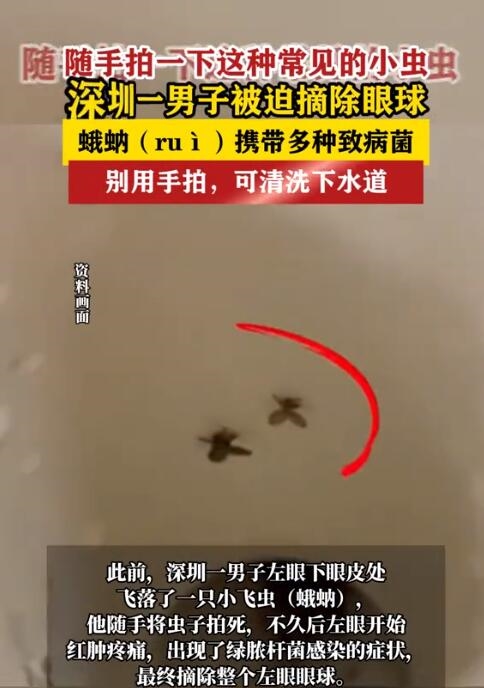 隨手拍死蛾蚋 男子被迫摘除眼球：出現(xiàn)了綠膿桿菌感染癥狀