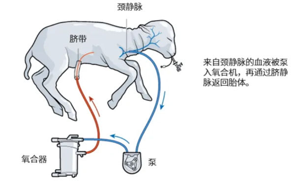 飆上熱搜的人造子宮 真的能讓男人也懷孕？