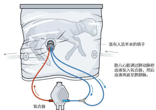 飆上熱搜的人造子宮 真的能讓男人也懷孕？